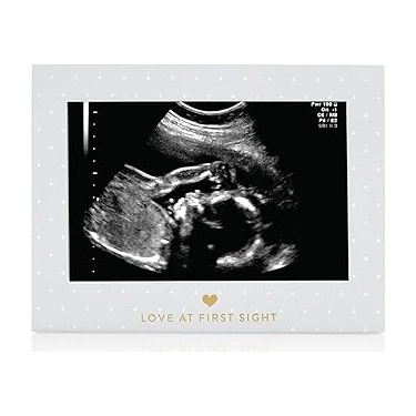 Uravas Store Sonogram Resim Çerçevesi Hamilelik Hatırası, Yakında Kız Bebek Veya Erkek Bebek Olacak